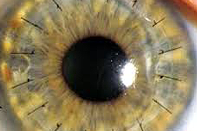 Corneal Disease